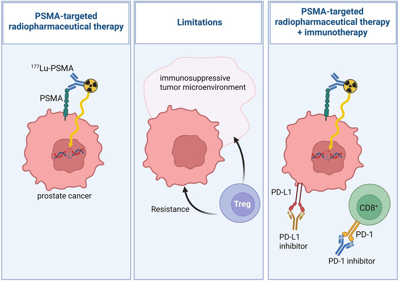 img-combinacion_de_la_terapia_radiofarmaceutica_dirigida_a_PSMA_con_inmunoterapia